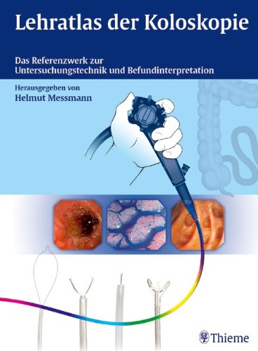 - Lehratlas der Koloskopie: Das Referenzwerk zur Untersuchungstechnik und Befundinterpretation
