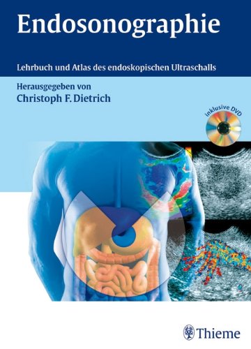 - Endosonographie: Lehrbuch und Atlas des endoskopischen Ultraschalls