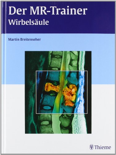 - Der MR-Trainer Wirbelsäule