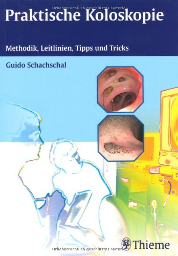 - Praktische Koloskopie: Methodik, Leitlinien, Tipps und Tricks