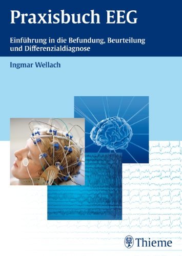  - Praxisbuch EEG: Einführung in die Befundung, Beurteilung und Differenzialdiagnose
