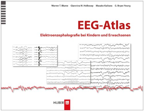 - EEG-Atlas: Elektroenzephalografie bei Kindern und Erwachsenen