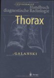 Freyschmidt, J. (HG) - Handbuch diagnostische Radiologie: Muskuloskelettales System 2