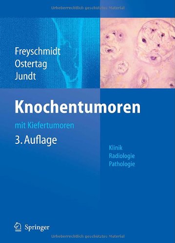 - Knochentumoren mit Kiefertumoren: Klinik - Radiologie - Pathologie