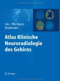  - Atlas Klinische Neuroradiologie: Wirbelsäule und Spinalkanal