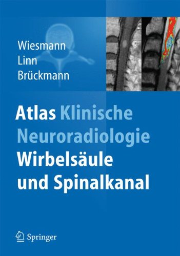  - Atlas Klinische Neuroradiologie: Wirbelsäule und Spinalkanal