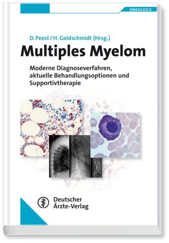 - Multiples Myelom: Moderne Diagnoseverfahren, aktuelle Behandlungsoptionen und Supportivtherapie