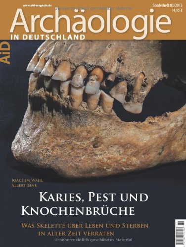 - Karies, Pest und Knochenbrüche