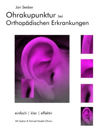 - Ohrakupunktur bei Orthopädischen Erkrankungen: Balancierte Ohrakupunktur: einfach, klar, effektiv