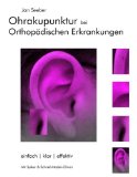  - Die 100 wichtigsten Akupunkturpunkte der Orthopädie: Mit einem Anhang zur Ohrakupunktur nach Nogier und Bahr