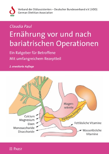  - Ernährung vor und nach bariatrischen Operationen: Ein Ratgeber für Betroffene  Mit umfangreichem Rezeptteil
