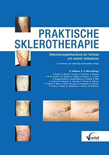 Hübner, K. / Breu, F. X. (Hrsg) - Praktische Sklerotherapie: Anleitung zur Sklerosierung der Varikose und anderer Indikationen