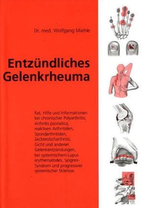 - Entzündliches Gelenkrheuma. Rat, Hilfe und Informationen